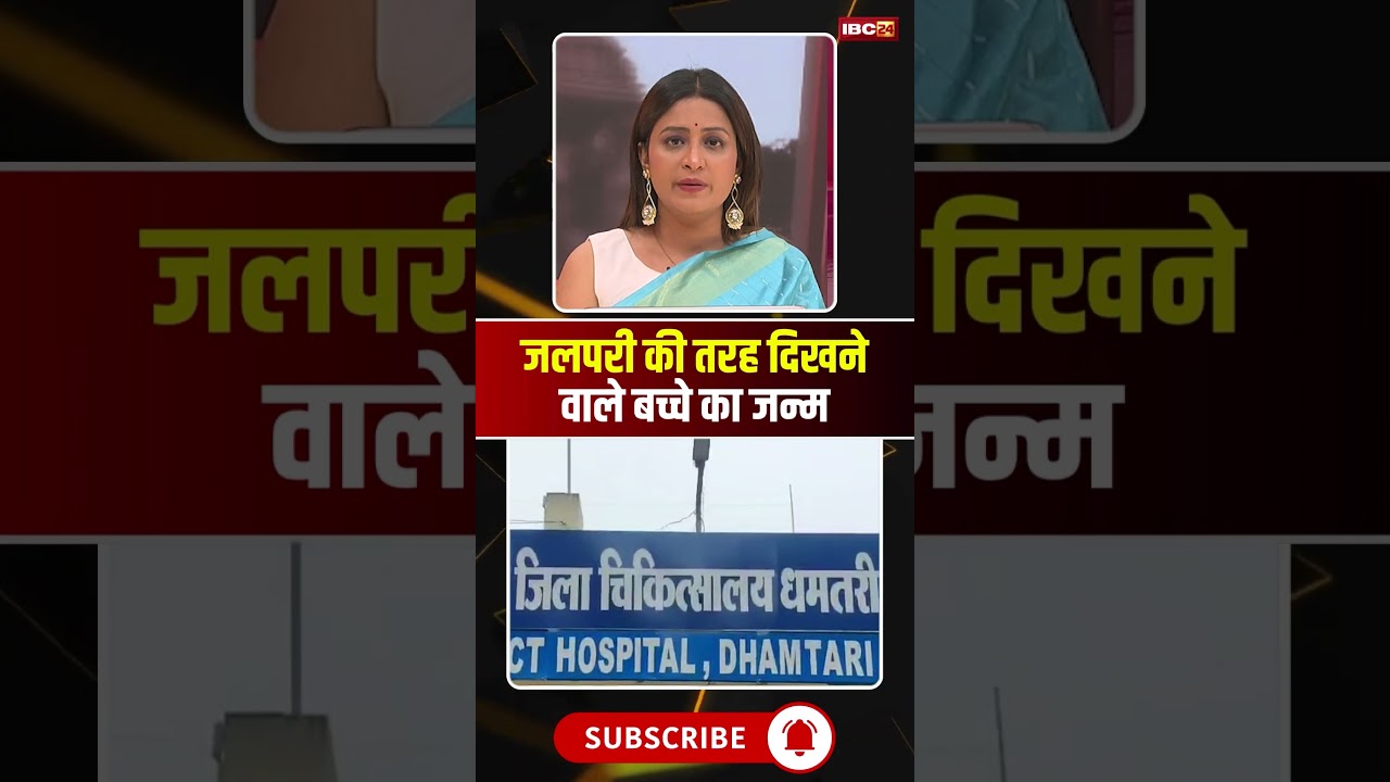 धमतरी में जलपरी की तरह दिखने वाले बच्चे का जन्म। #dhamtari #cgnews #viralshorts
