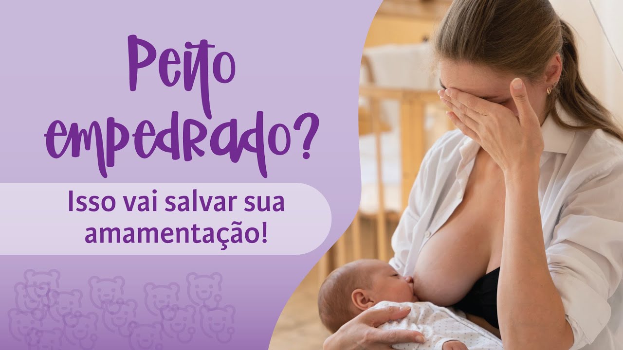 COMO FAZER MASSAGEM NO PEITO EMPEDRADO? A MASSAGEM SALVA SUA AMAMENTAÇÃO! | PEDIATRIA DESCOMPLICADA