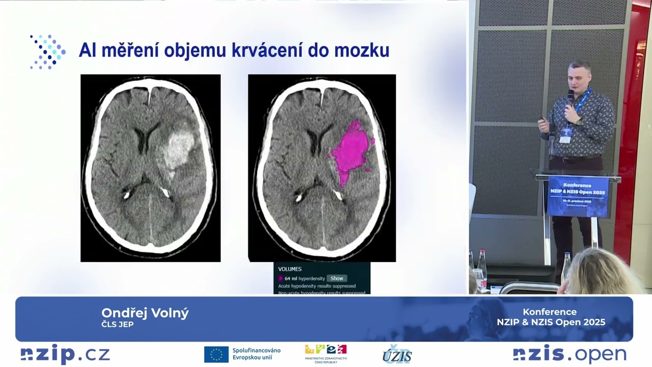 AI a moderní technologie (nejen) v neurologii – praktické zkušenosti (O. Volný)