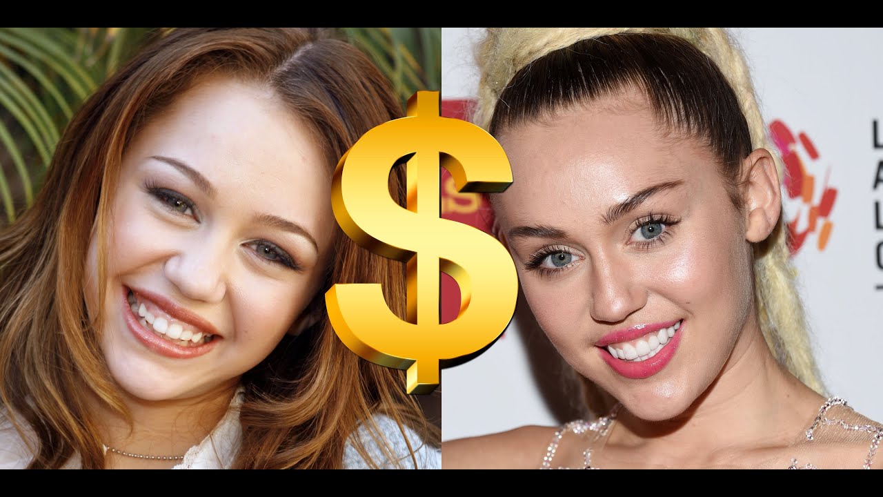 Top 10 Most Expensive Celebrity Smile Makeover!