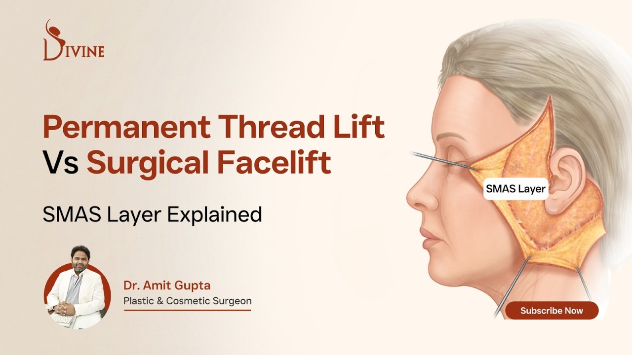 Permanent Thread Lift vs Surgical Facelift | SMAS Layer Explained | Dr Amit Gupta
