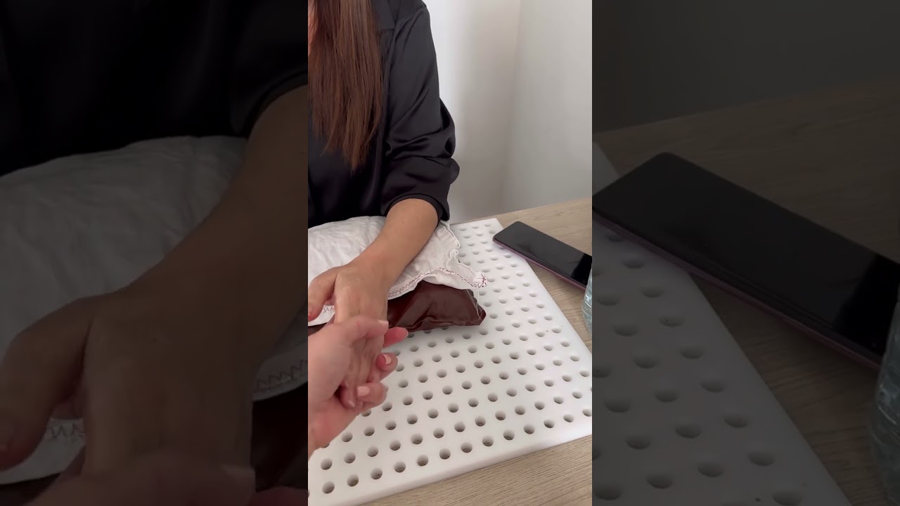 Premier retour d’une patiente avec algodystrophie après sa chirurgie de neurostimulateur médullaire