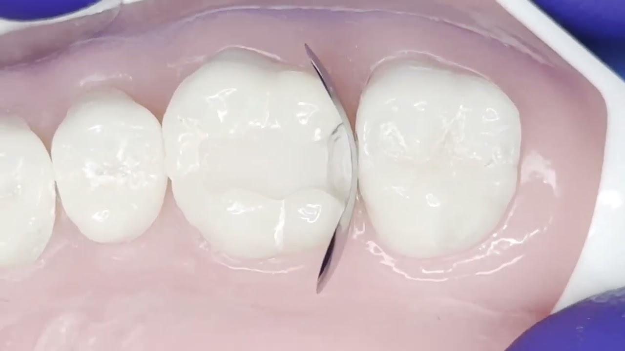 Testimonial myQuickmat classico Starter Kit