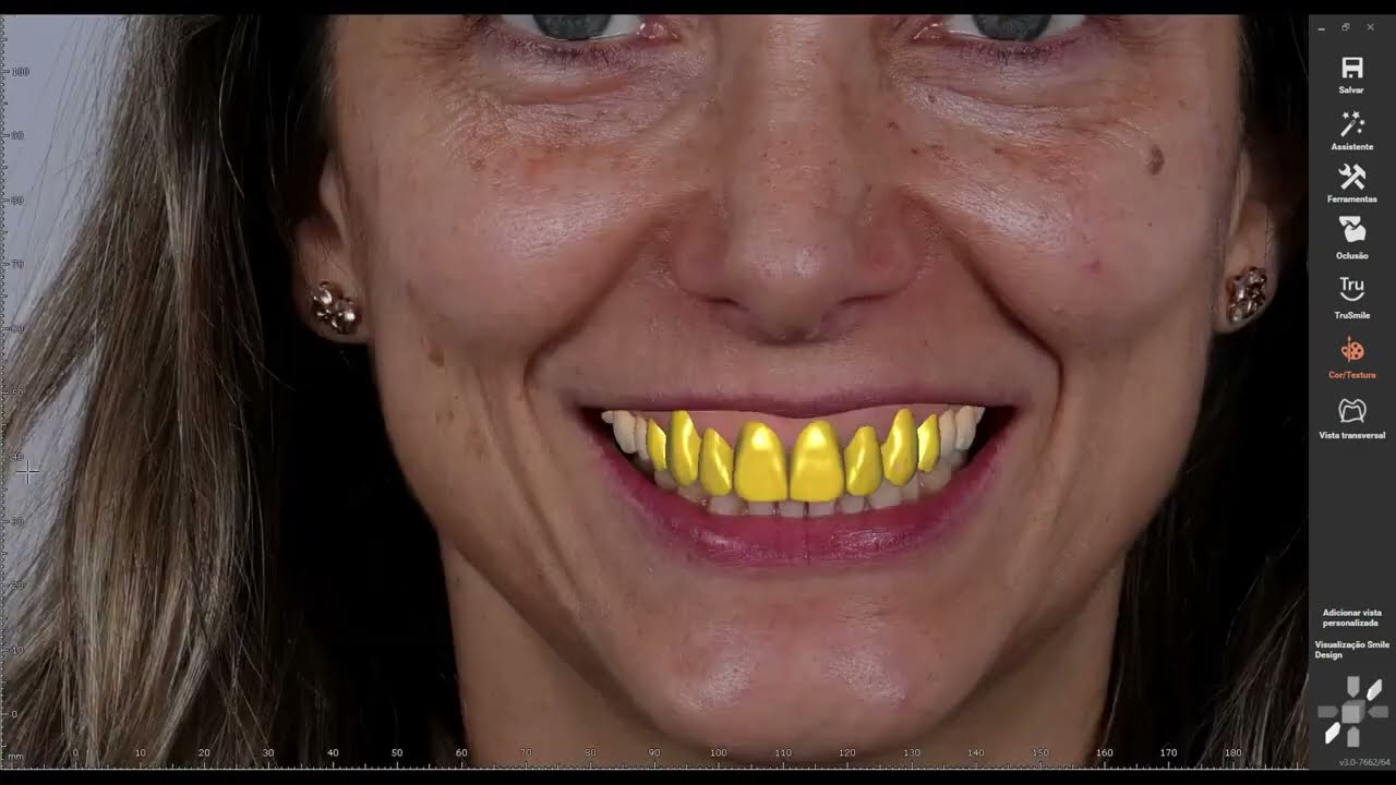 SmileBoost® Lo importante para nosotros