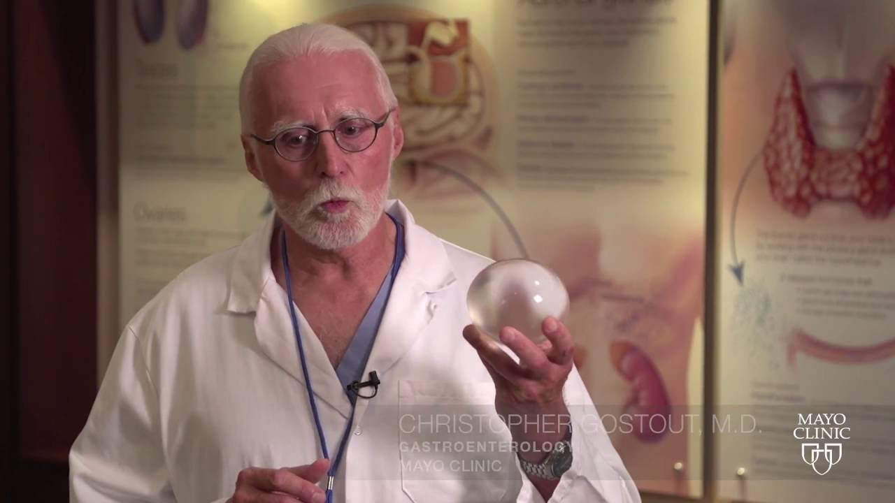 Mayo Clinic Minute - Intragastric Balloon for Weight Loss