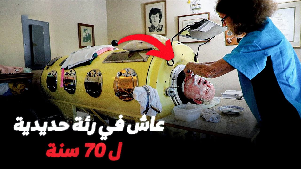 رجل الرئة الحديدية لم يغادرها منذ 70 سنة