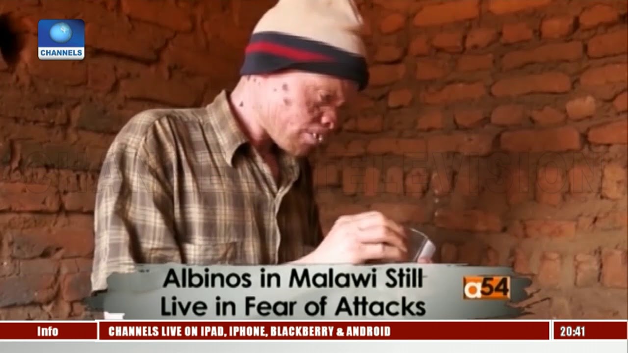 Attacks: Dangerous Times For Albinos In Malawi|Africa 54|