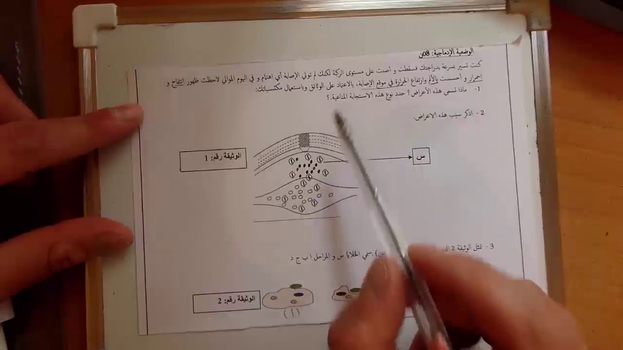 حل وضعية ادماجية خاصة بالتفاعل الالتهابي تحضيرا لشهادة التعليم المتوسط