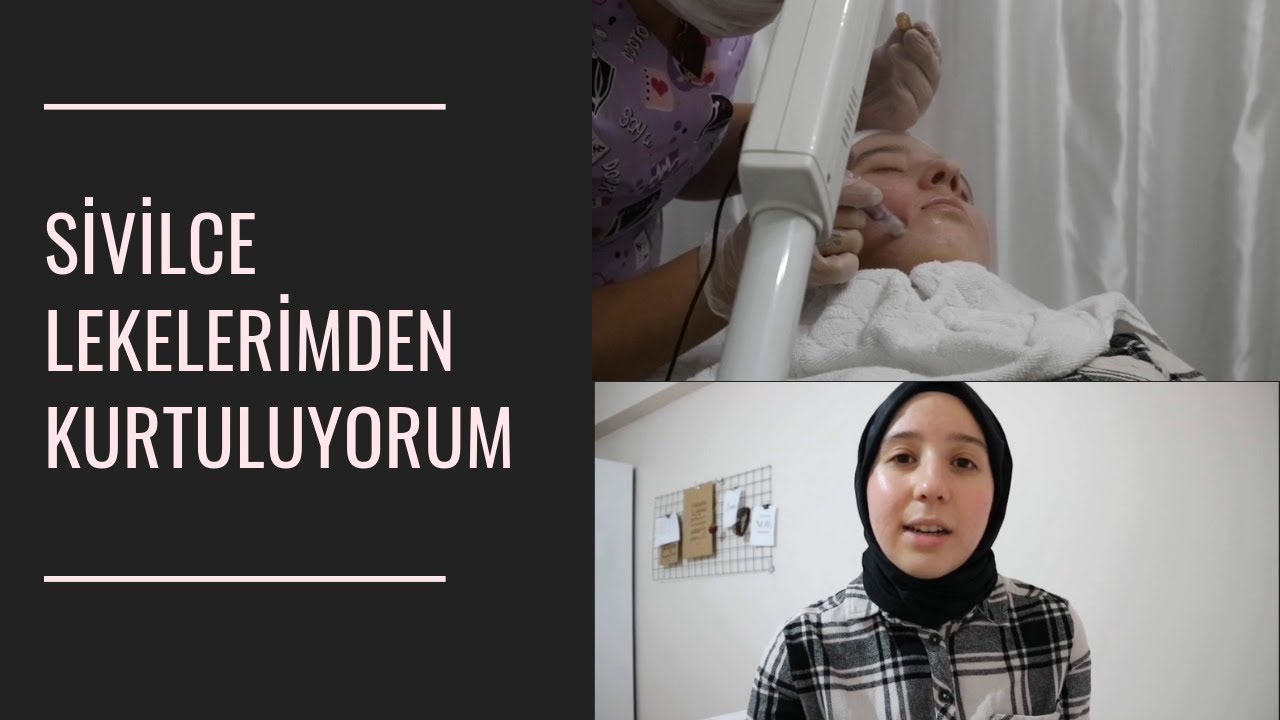 DERMAPEN YAPTIRDIM | İLK SEANSIM