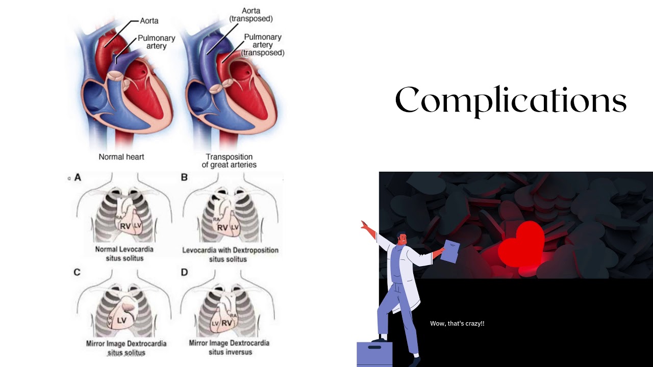 Situs Inversus Project