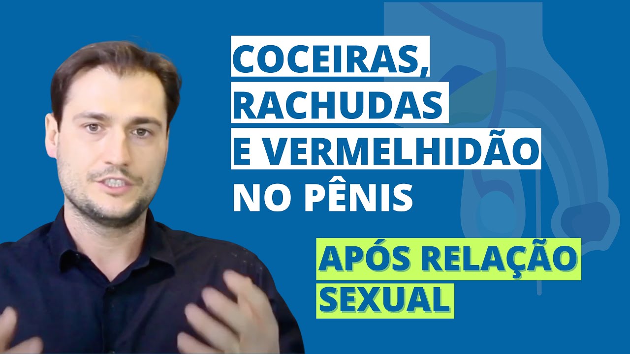 Coceiras, rachaduras, vermelhid&atilde;o e escama&ccedil;&atilde;o no p&ecirc;nis ap&oacute;s rela&ccedil;&atilde;o sexual?