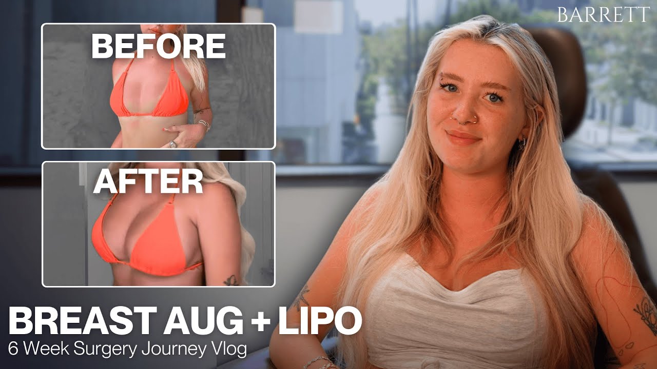 From Uniboob to Confident | Kayla Malec’s Breast Augmentation Journey