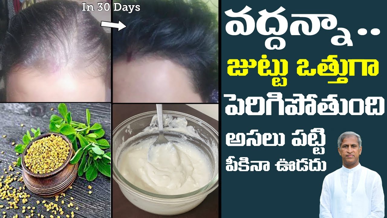 వద్దన్నా!! జుట్టు పెరిగిపోతుంది అసలు పట్టి పీకినా ఊడదు | Dr Manthena Satyanarayana Raju Videos
