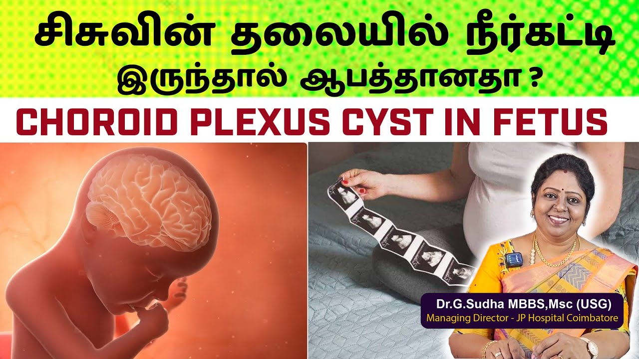 சிசுவின் தலையில் நீர்கட்டி இருந்தால் ஆபத்தானதா? Choroid Plexus Cyst in Fetus :  Dr. G. Sudha