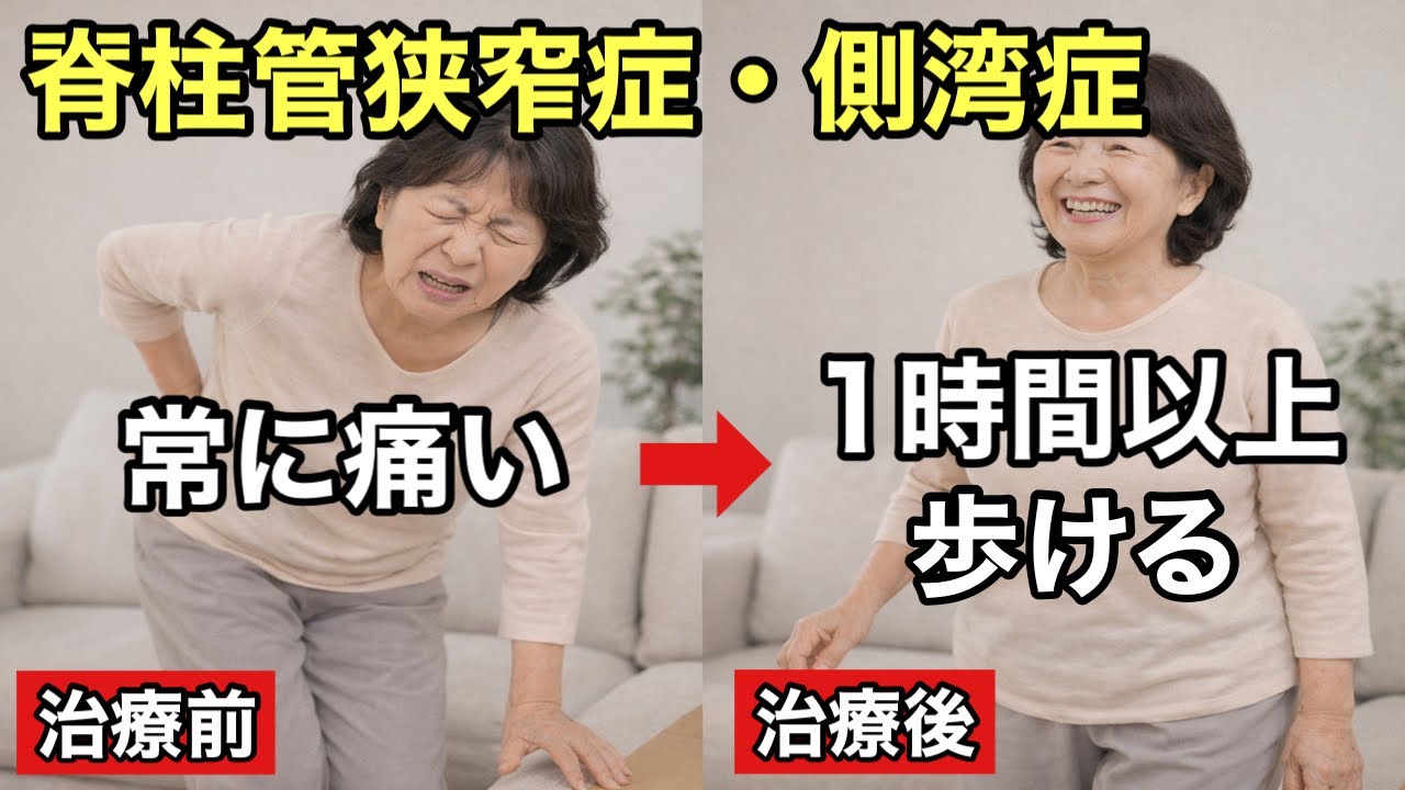 【脊柱管狭窄症・側湾症】坐骨神経痛で動けなくなり、何をしていても痛かったのが改善✨大阪の西住之江鍼灸整体院