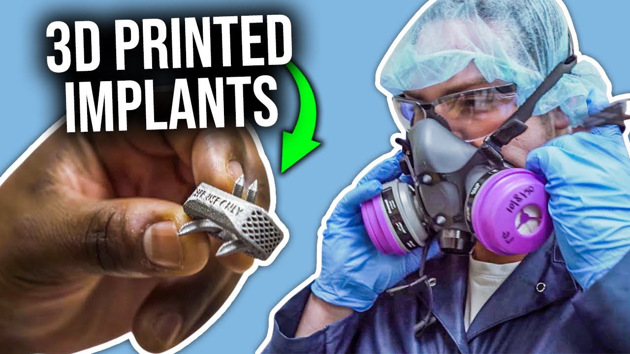 3D Printing in Spine Surgery | Patient Specific Implants