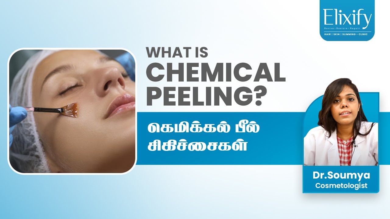How & When to do Chemical Peeling | Elixify | Tamil
