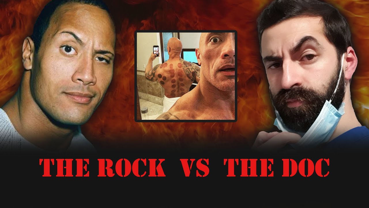 Does Cupping Work? Doc vs The Rock - Pseudoscience Royal Rumble!