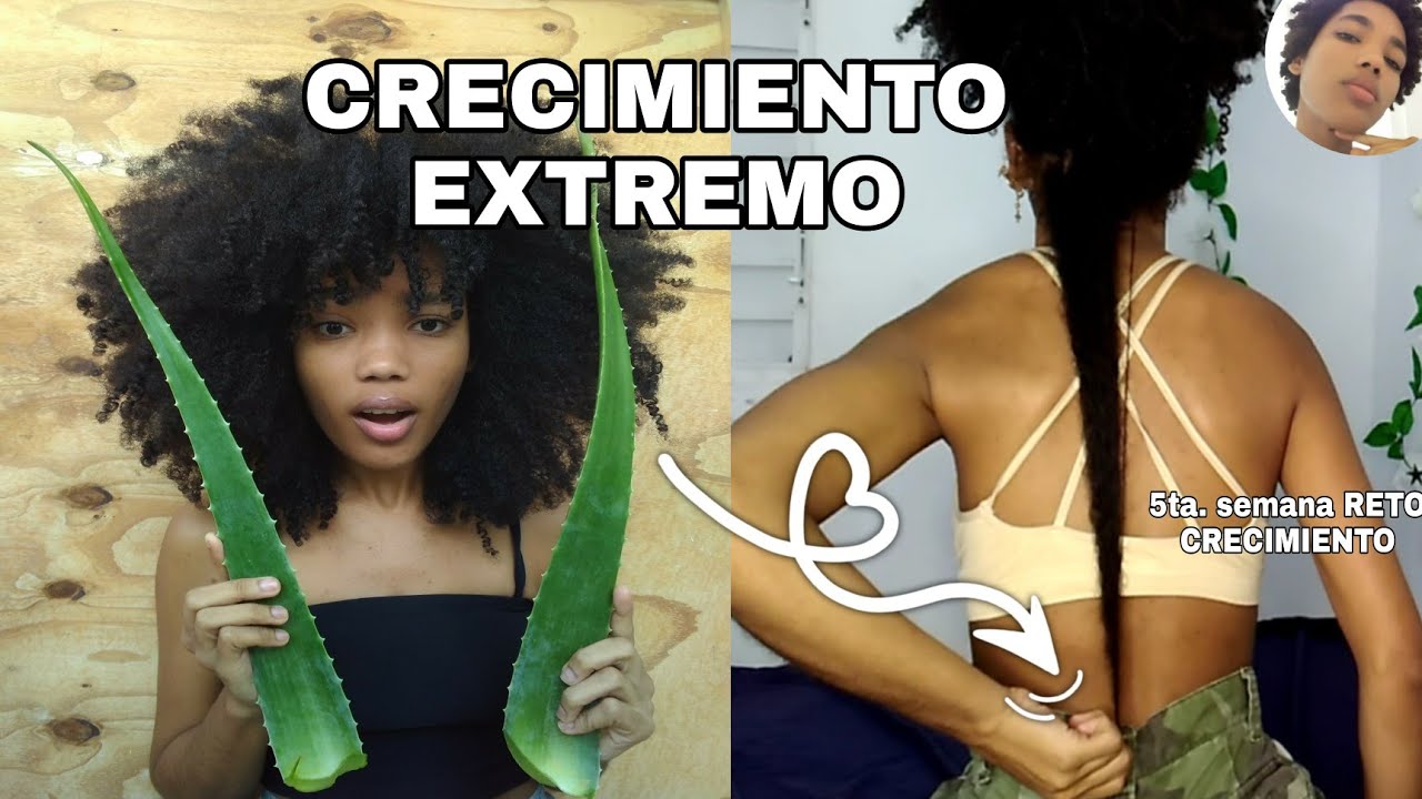SÁBILA PARA HACER CRECER EL CABELLO RÁPIDO|TRATAMIENTO CASERO CRECIMIENTO Y ANTICAÍDA|Rachell Santos