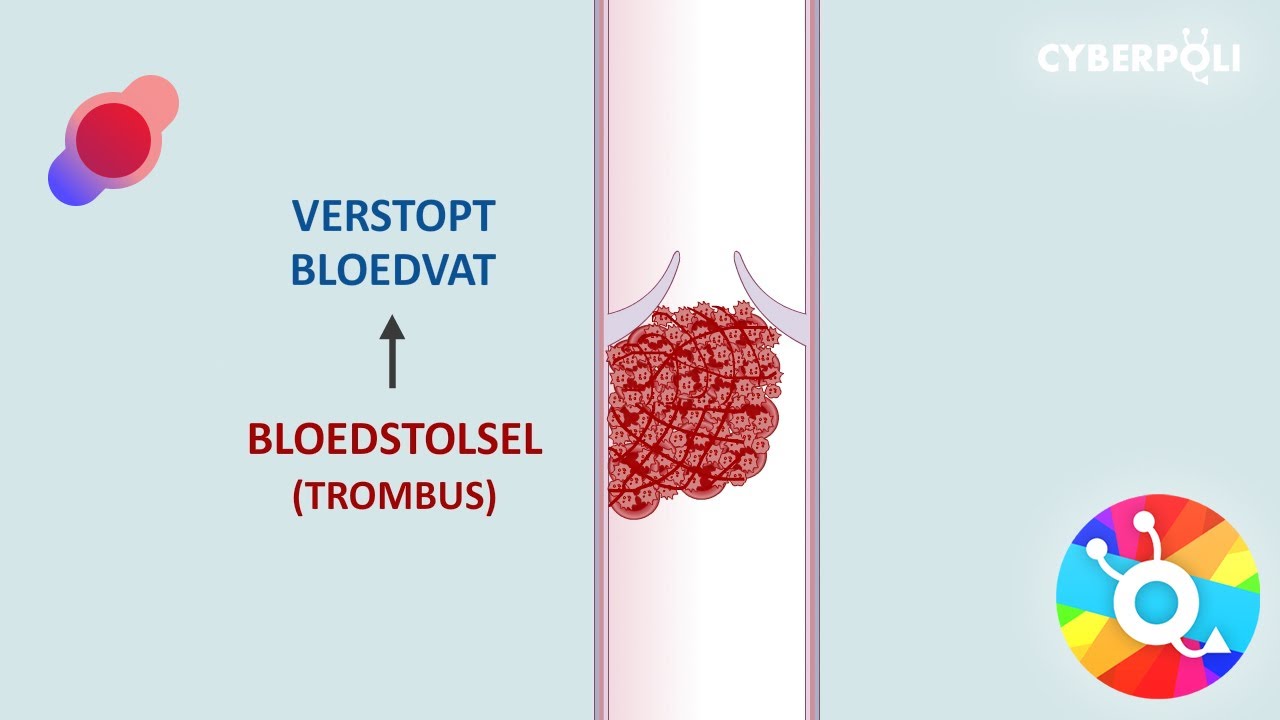 Wat is trombose?