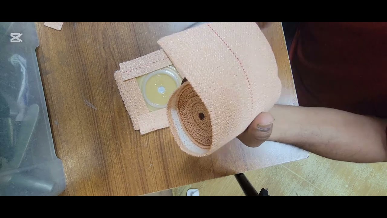 পেটের ব্যাগ বসাতে অযথা টাকা খরচ না করি।।colostomy bag#পেটের ব্যাগ#স্টোমা ব্যাগ#ক্লোসটমি ব্যাগ#ব্যাগ