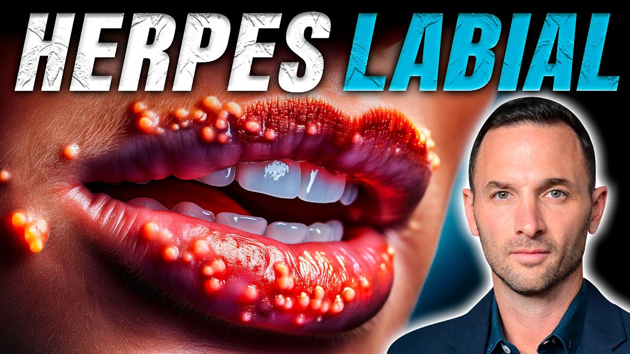 El Tratamiento NATURAL más EFECTIVO contra el HERPES LABIAL