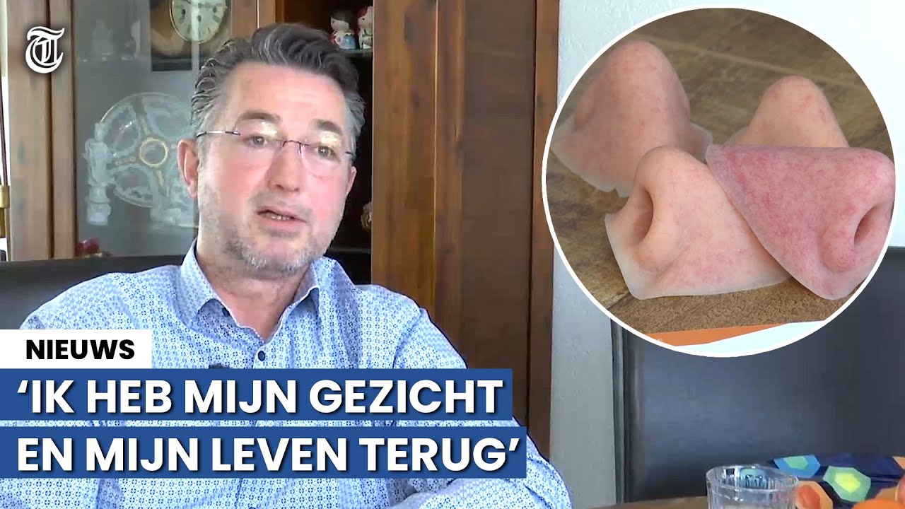 Jomaro verloor &oacute;&oacute;k neus: &lsquo;Schrok toen Dieuwertje Blok belde&rsquo;