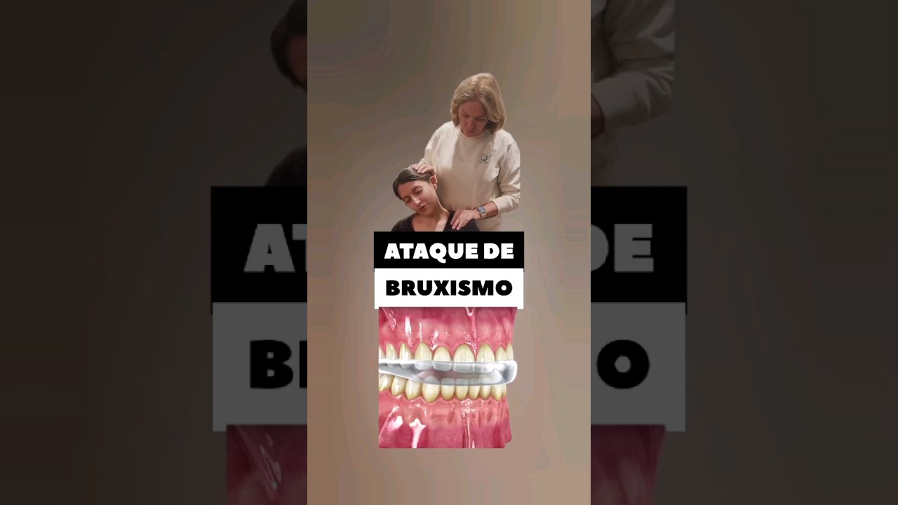 ATAQUE DE BRUXISMO