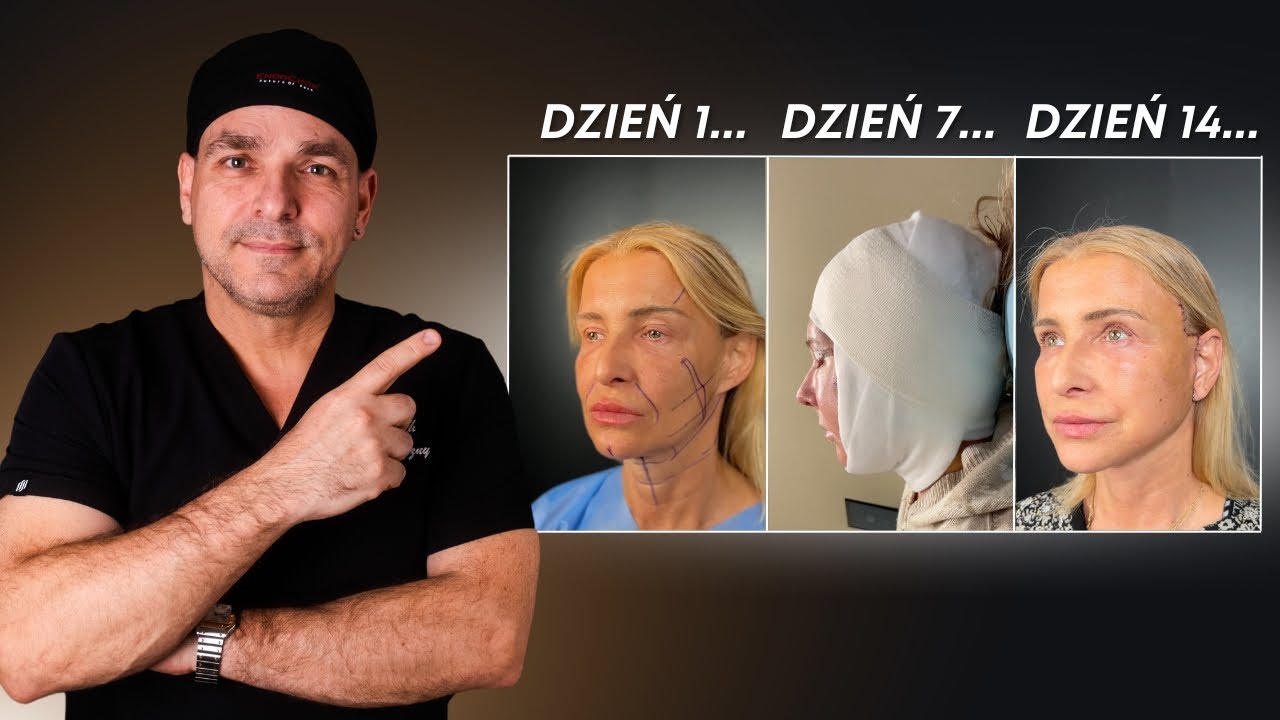 Lifting twarzy dzień po dniu: od sali operacyjnej do efektu!