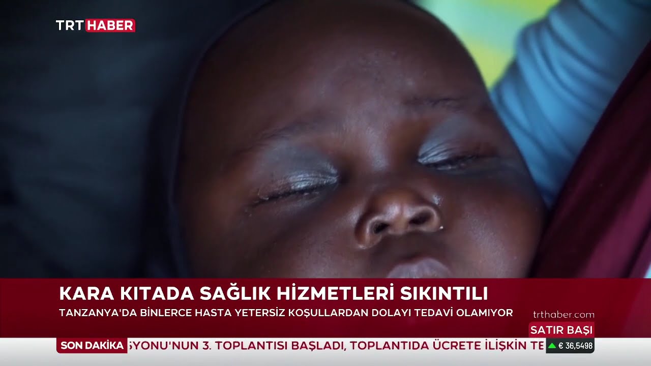 TRT Haber'de Tanzanya Sağlık Ekibimizin Umut Yolculuğu | Çare Derneği