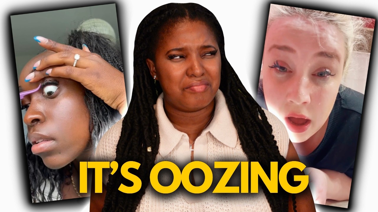 Lash Extension RUINED These People's Eyes