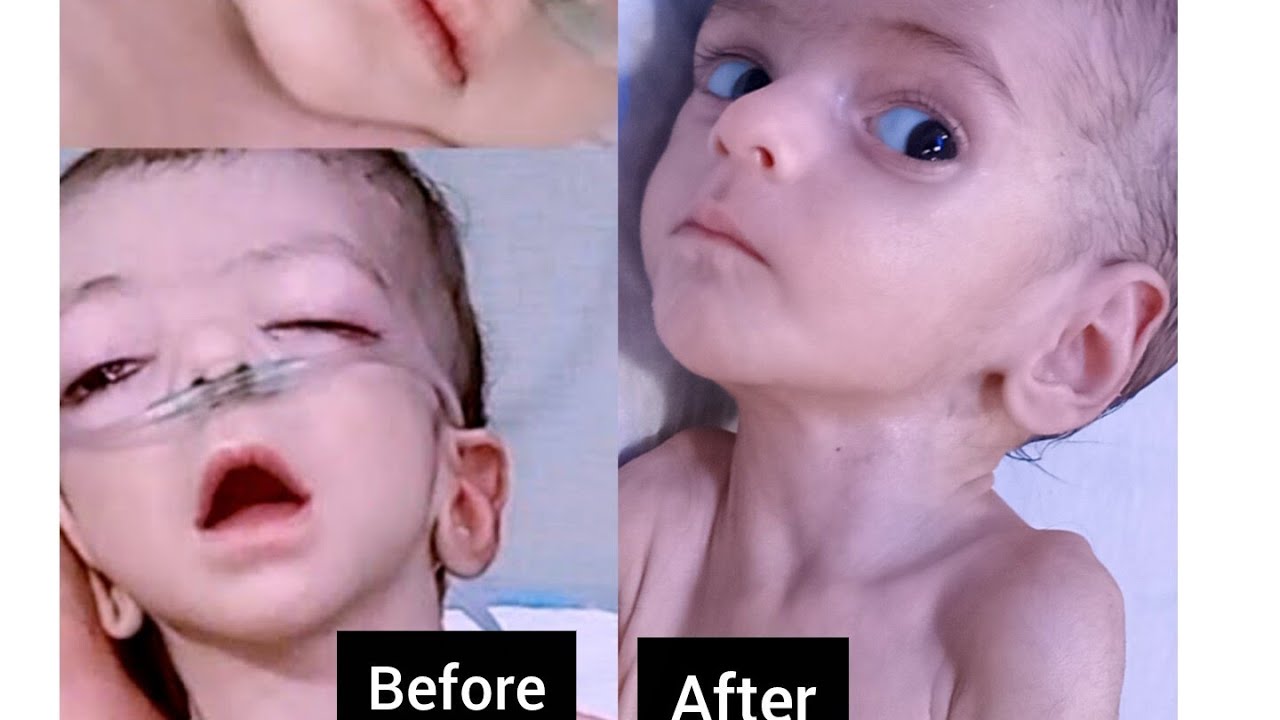 Week-Old Neonatal Baby in NICU | Gasping and Critical.@☆Payer's 🤲😭●!!