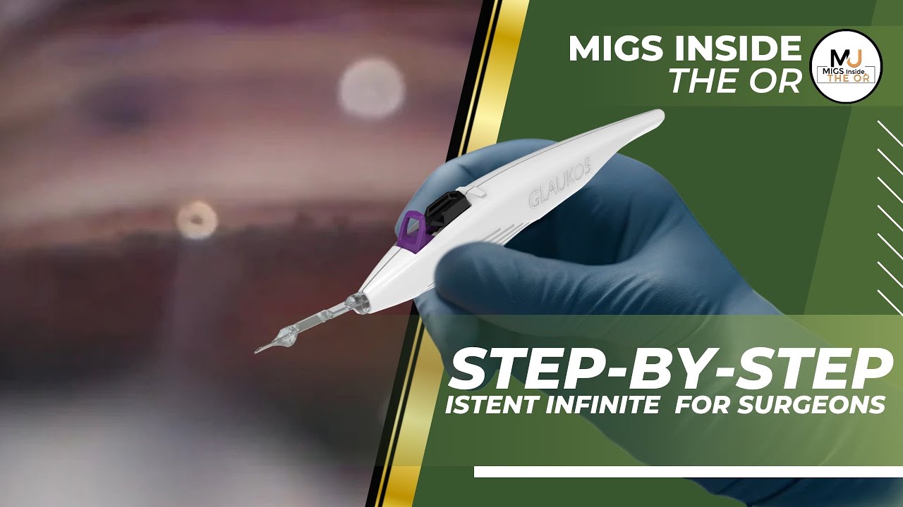 iStent infinite&reg; Surgical Walkthrough  | #MIGS Inside the OR #glaucomasurgery