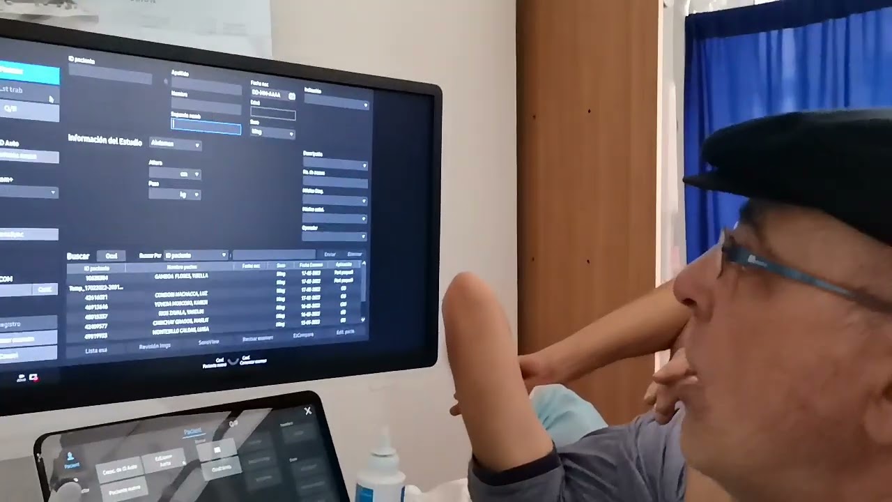 Por fin llegó el Ecógrafo V8 de Samsung!!