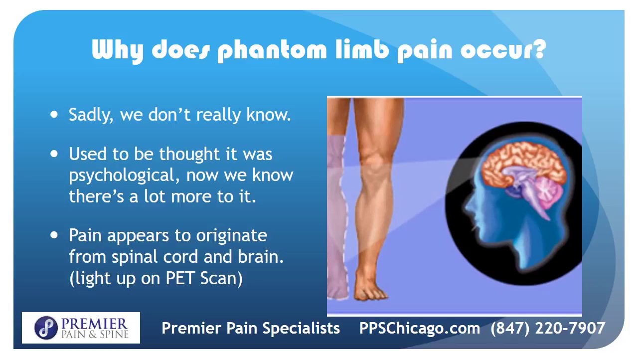 Overview of Phantom Limb Pain Treatment in Chicago (847) 220-7907
