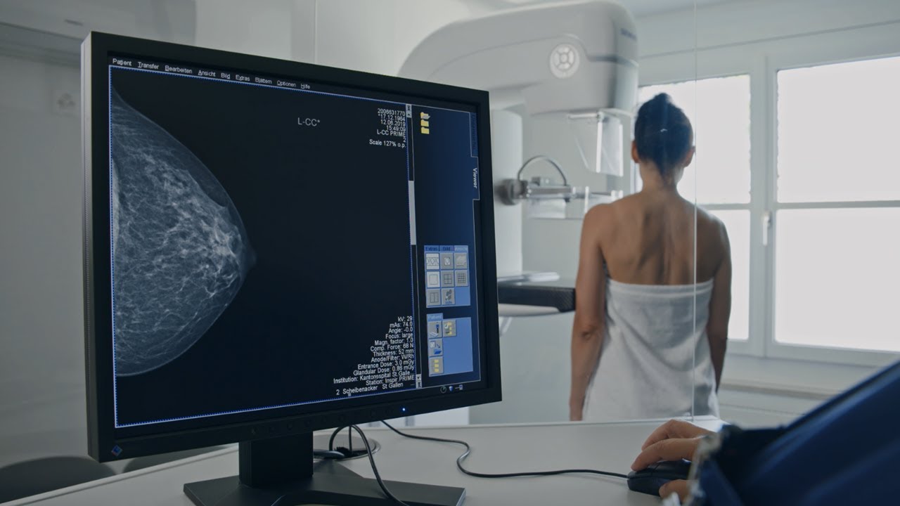 Mammographie &ndash; wie funktioniert das?