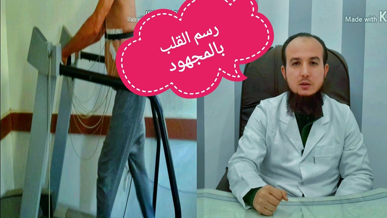 رسم القلب بالمجهود (جهاز جهد القلب) _ Stress ECG