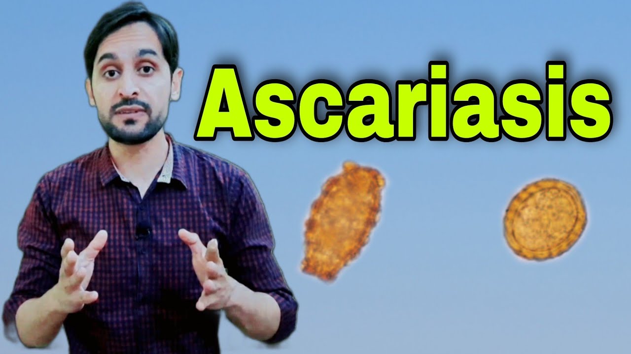 Ascariasis Infection | Ascaris Lumbricoides | Diagnosis | Life Cycle and Treatment