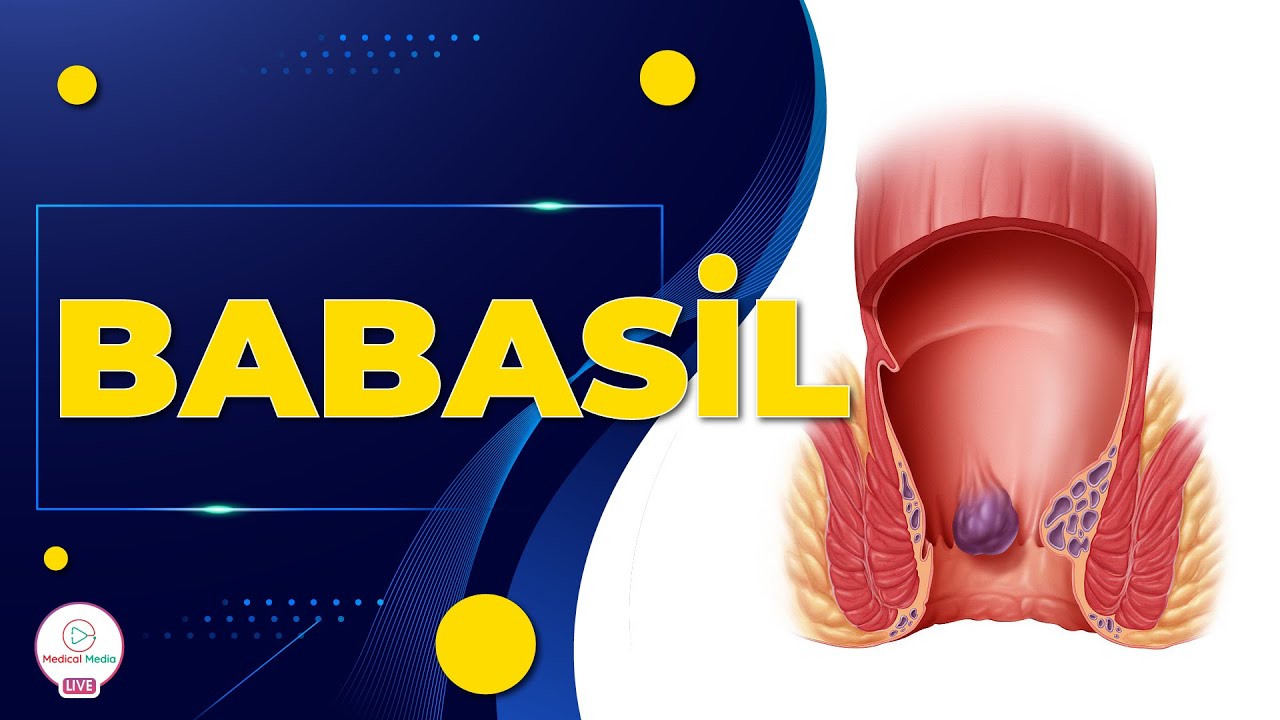 BABASİL / BABASİLİN YARANMA SƏBƏBLƏRİ / BABASİLİN MÜALİCƏSİ