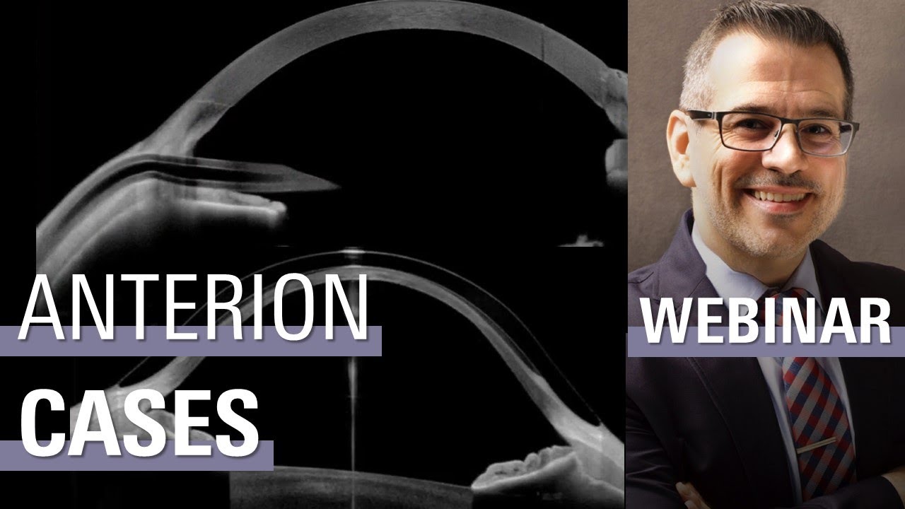 AS-OCT: How Technology is Advancing Clinical Corneal Assessment | ANTERION