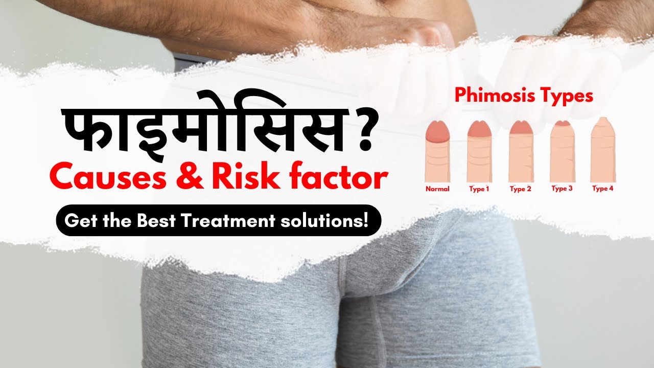 हिंदी में - Types &  Risk Factor of Phimosis | Best Treatment for Phimosis | Surgery or Home Care?