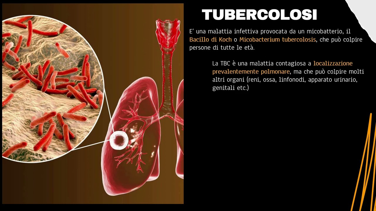 MALATTIE INFETTIVE _ INFLUENZA E TBC