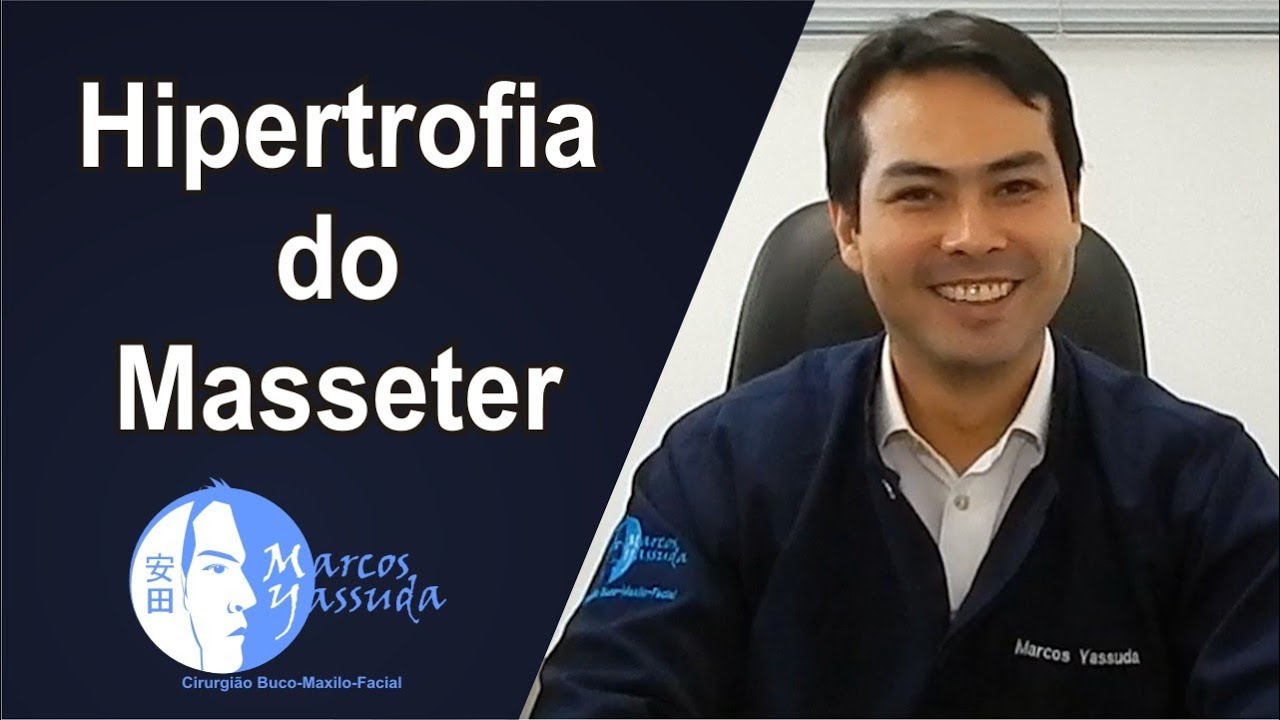 Hipertrofia do Masseter   Como diminuir o masseter