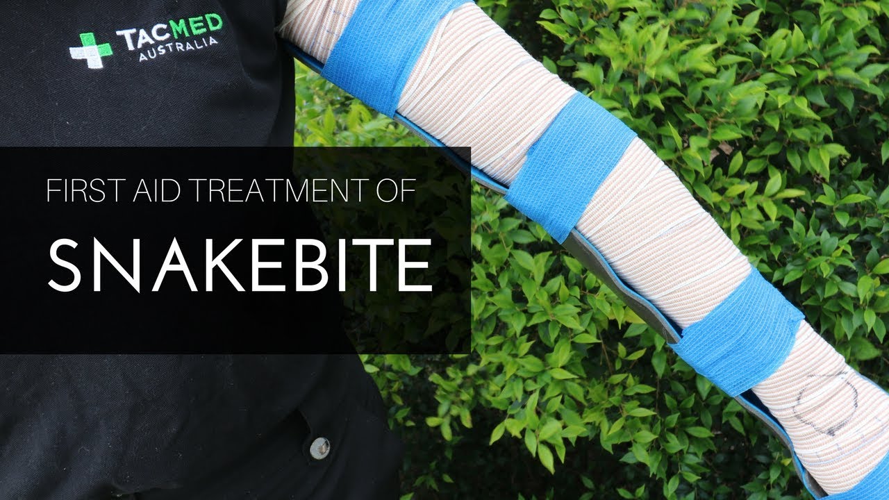 Pressure Immobilisation Technique for Snakebite