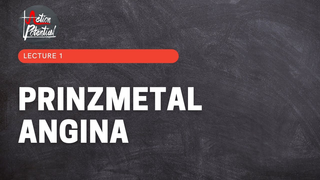 Prinzmetal Angina