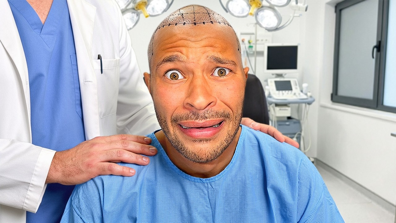 I Finally Got A Hair Transplant!!