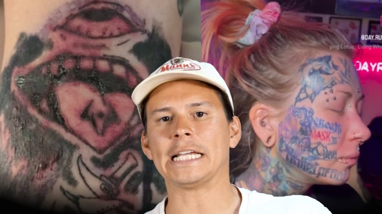 Опасная для жизни инфекция, вызывающая появление татуировки