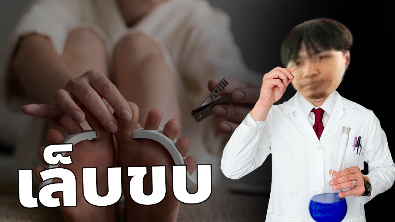 ประสบการ์ณการเป็นเล็บขบ
