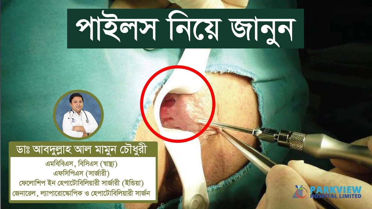 পাইলস এর লক্ষণ, কারণ, চিকিৎসা সম্পর্কে জানুন এবং সচেতন হোন!