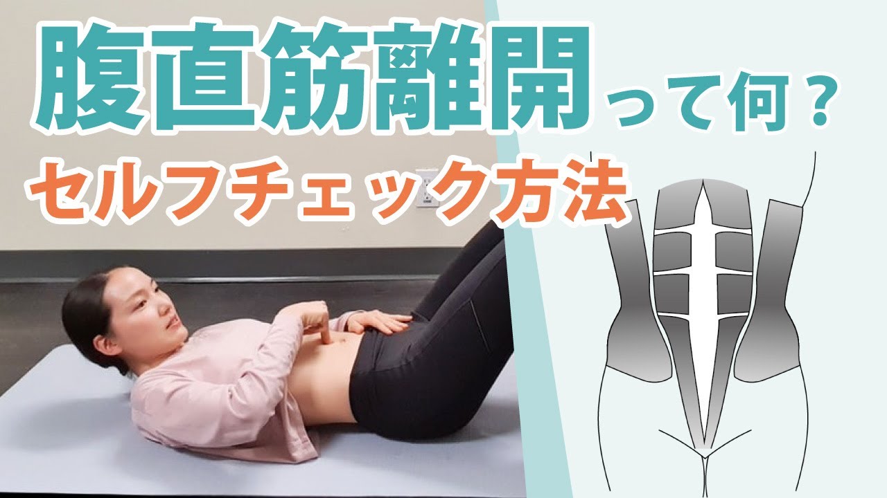 妊娠・出産で起こる腹直筋離開とは？腹直筋離開のセルフチェック方法と、産後すぐにしてはいけない運動